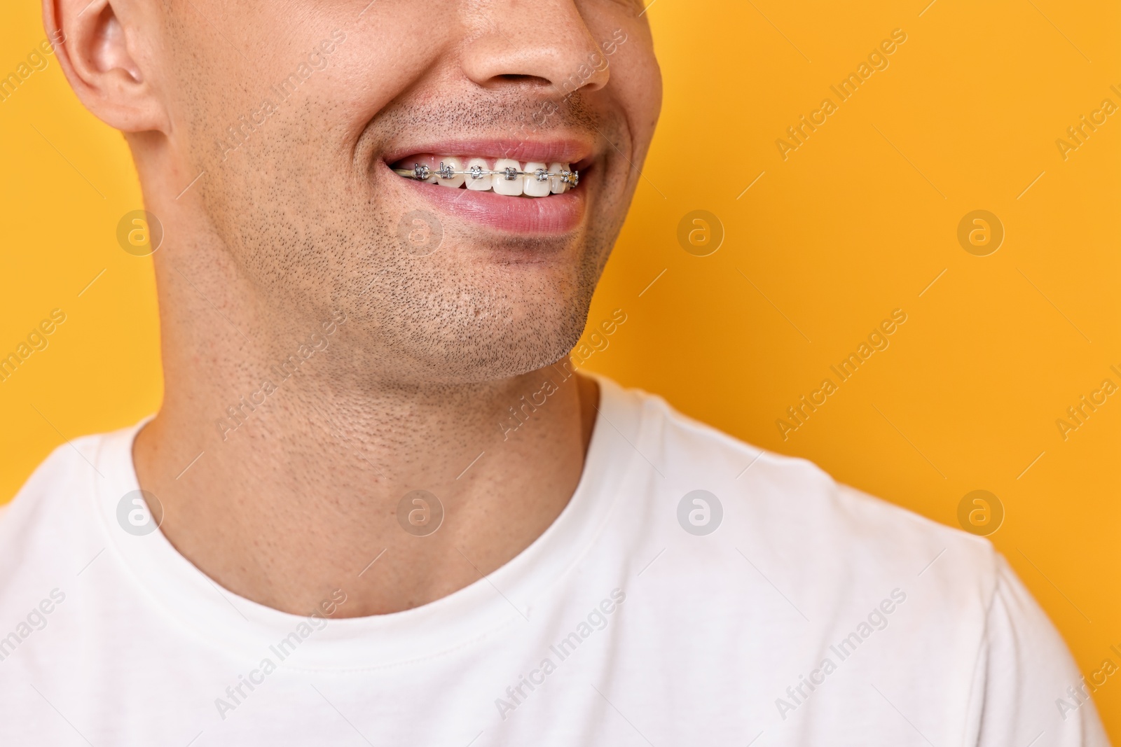 Photo of Smiling man with dental braces on yellow background, closeup