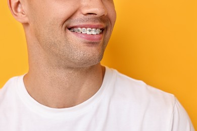 Smiling man with dental braces on yellow background, closeup