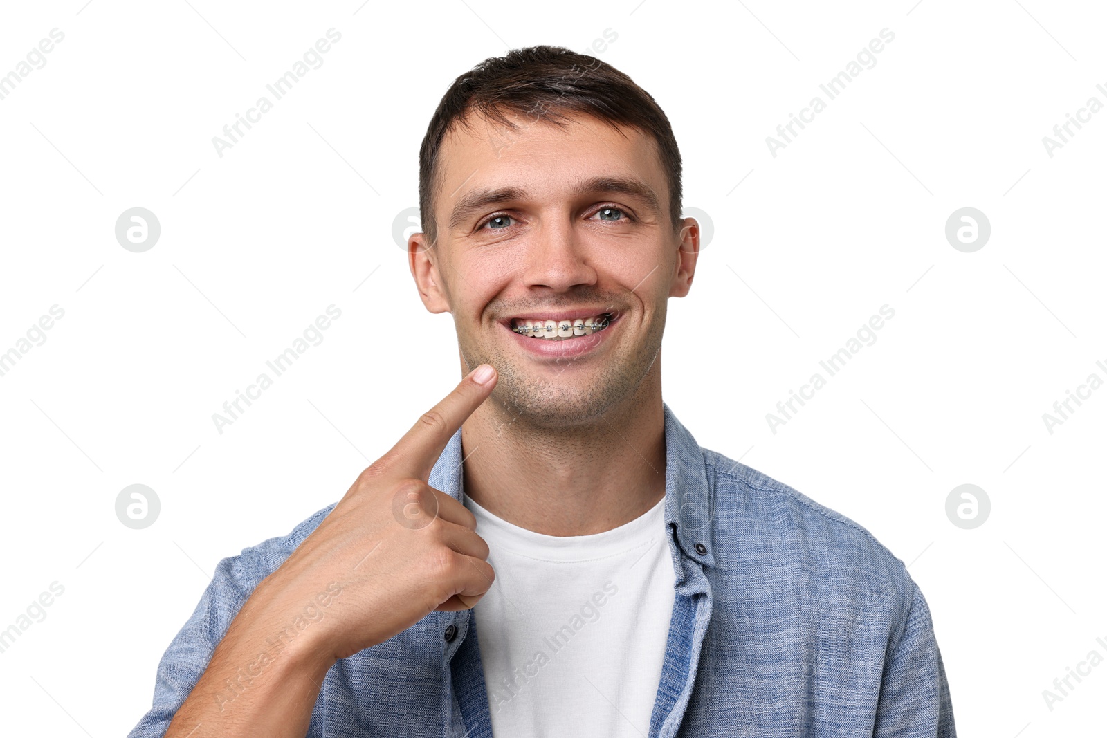 Photo of Smiling man pointing at his dental braces on white background