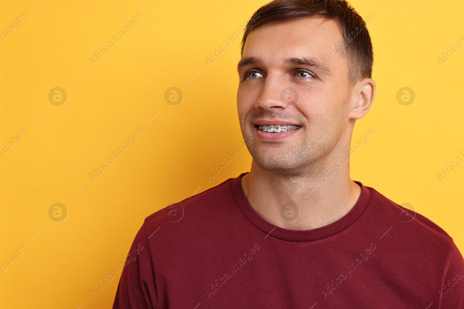 Photo of Smiling man with dental braces on yellow background. Space for text