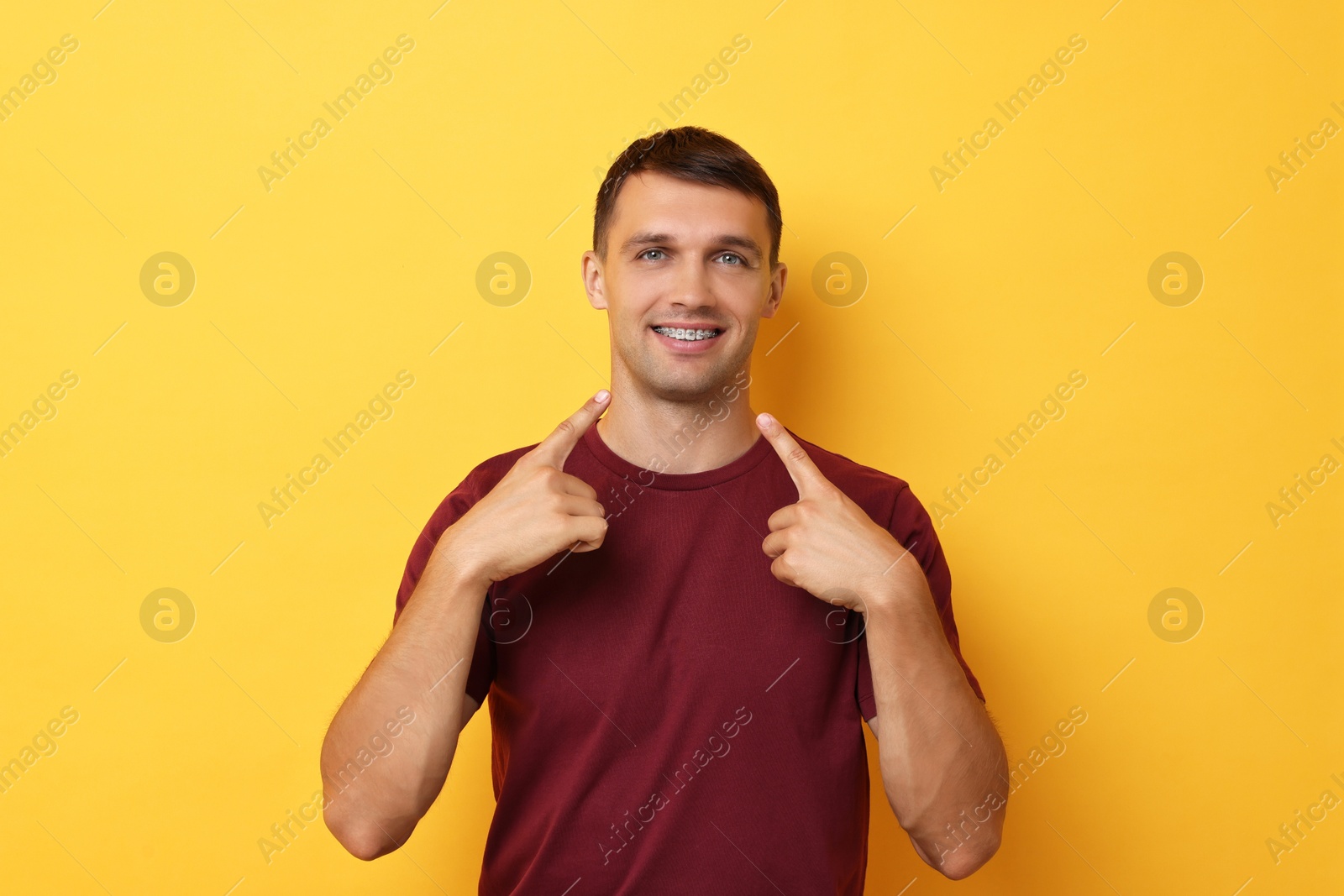 Photo of Smiling man pointing at his dental braces on yellow background