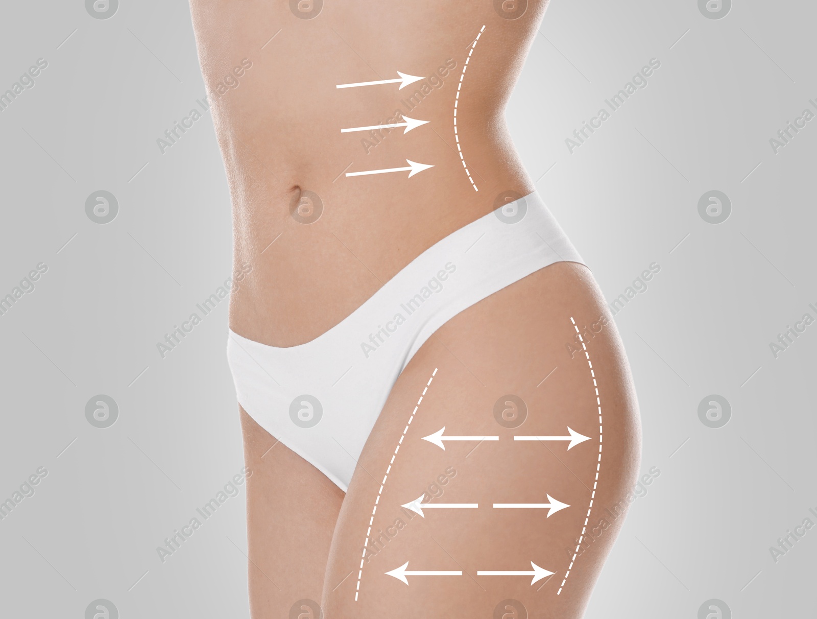 Image of Woman with perfect slim body on light grey background, closeup. Figure correction arrows and lines on skin