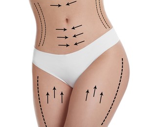 Image of Woman with perfect slim body on white background, closeup. Figure correction arrows and lines on skin