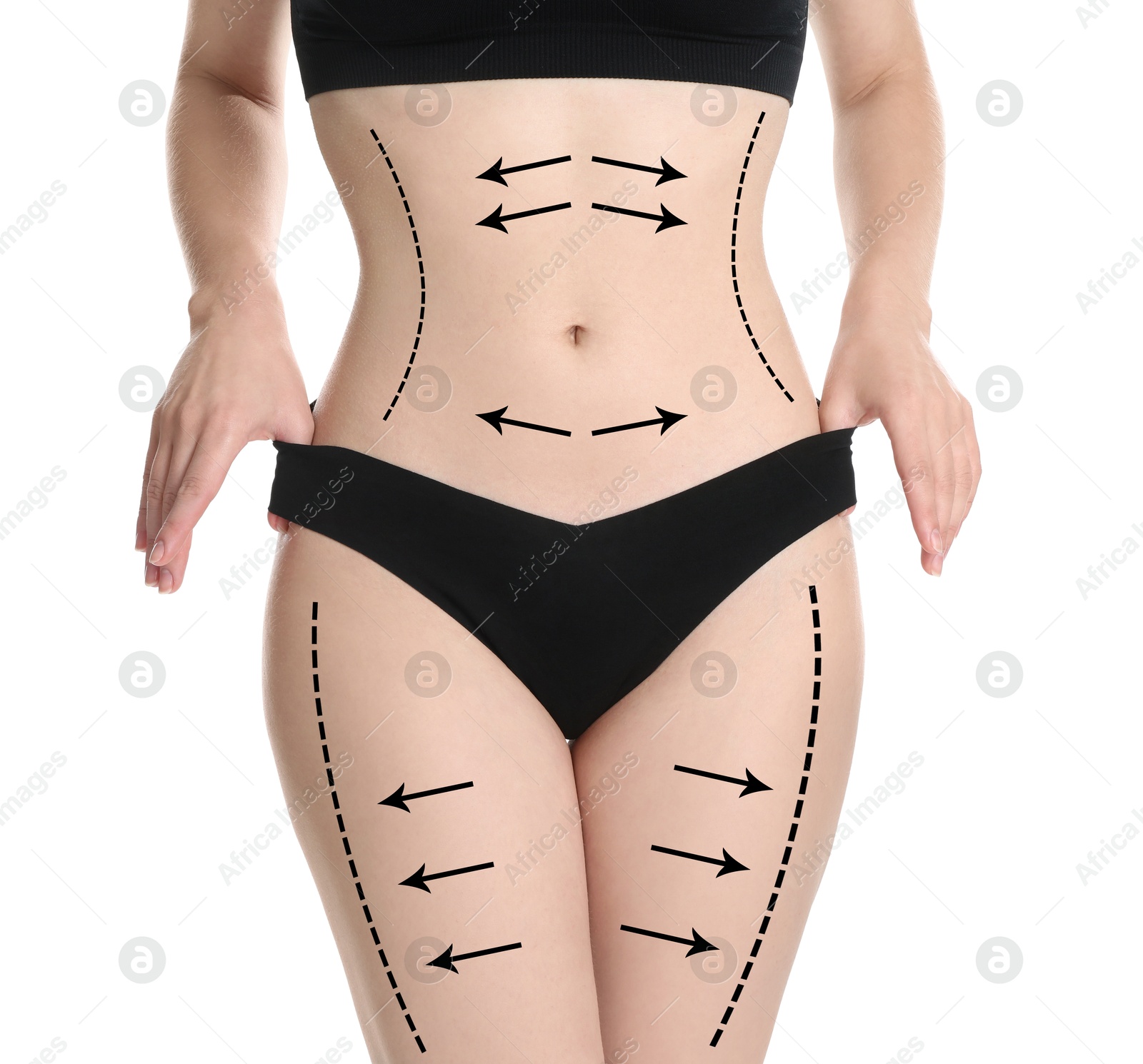 Image of Woman with perfect slim body on white background, closeup. Figure correction arrows and lines on skin