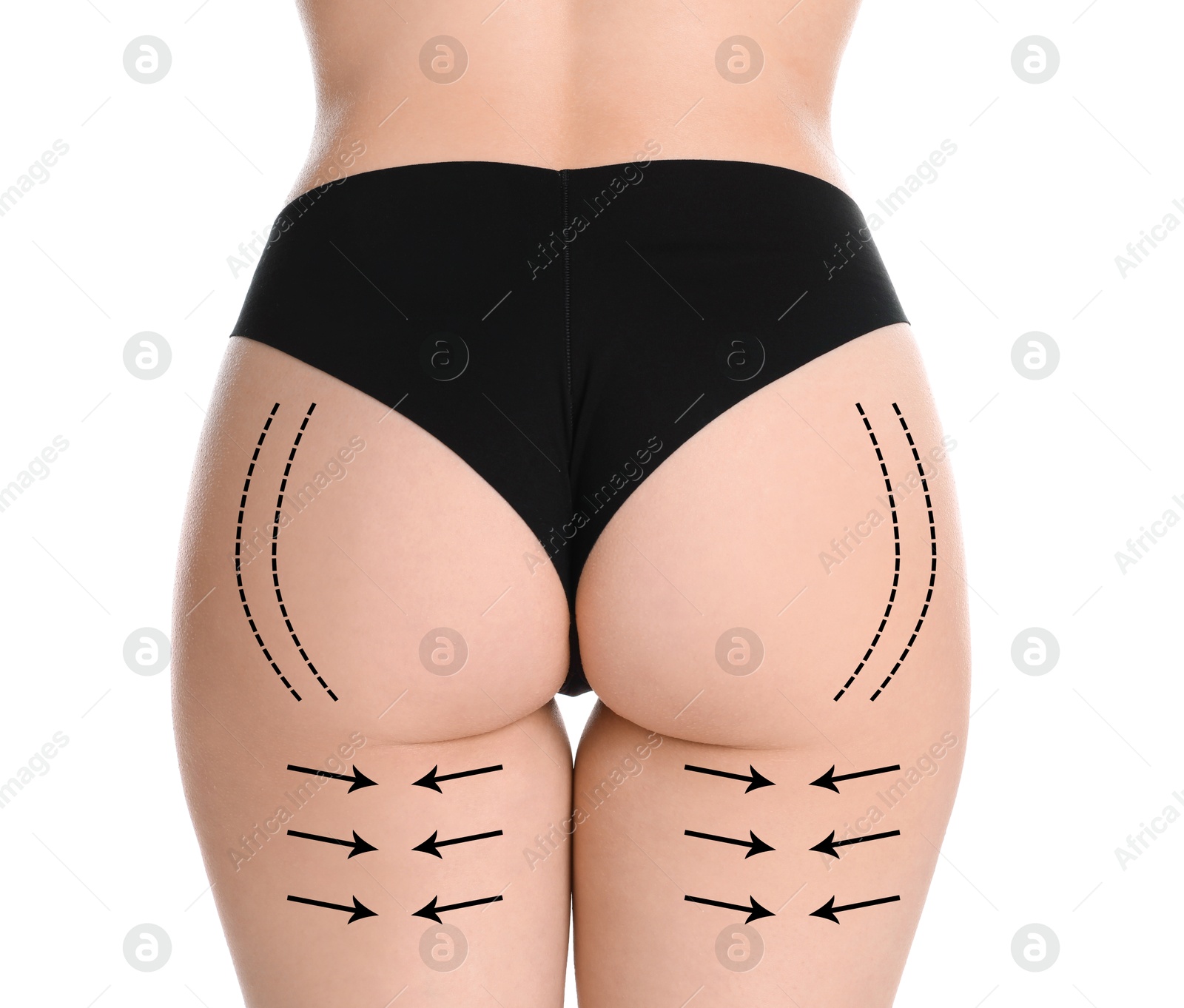 Image of Woman with perfect slim body on white background, closeup. Figure correction arrows and lines on skin