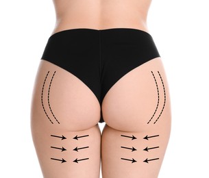 Woman with perfect slim body on white background, closeup. Figure correction arrows and lines on skin