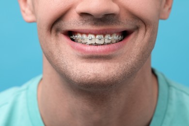 Smiling man with dental braces on light blue background, closeup