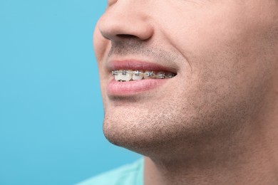 Smiling man with dental braces on light blue background, closeup. Space for text