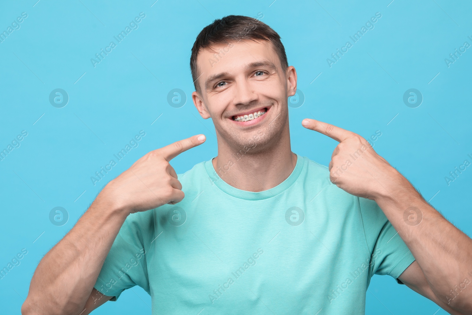 Photo of Smiling man pointing at his dental braces on light blue background