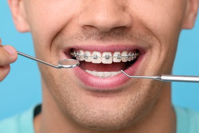 Examination of man's teeth with braces using dental tools on light blue background, closeup