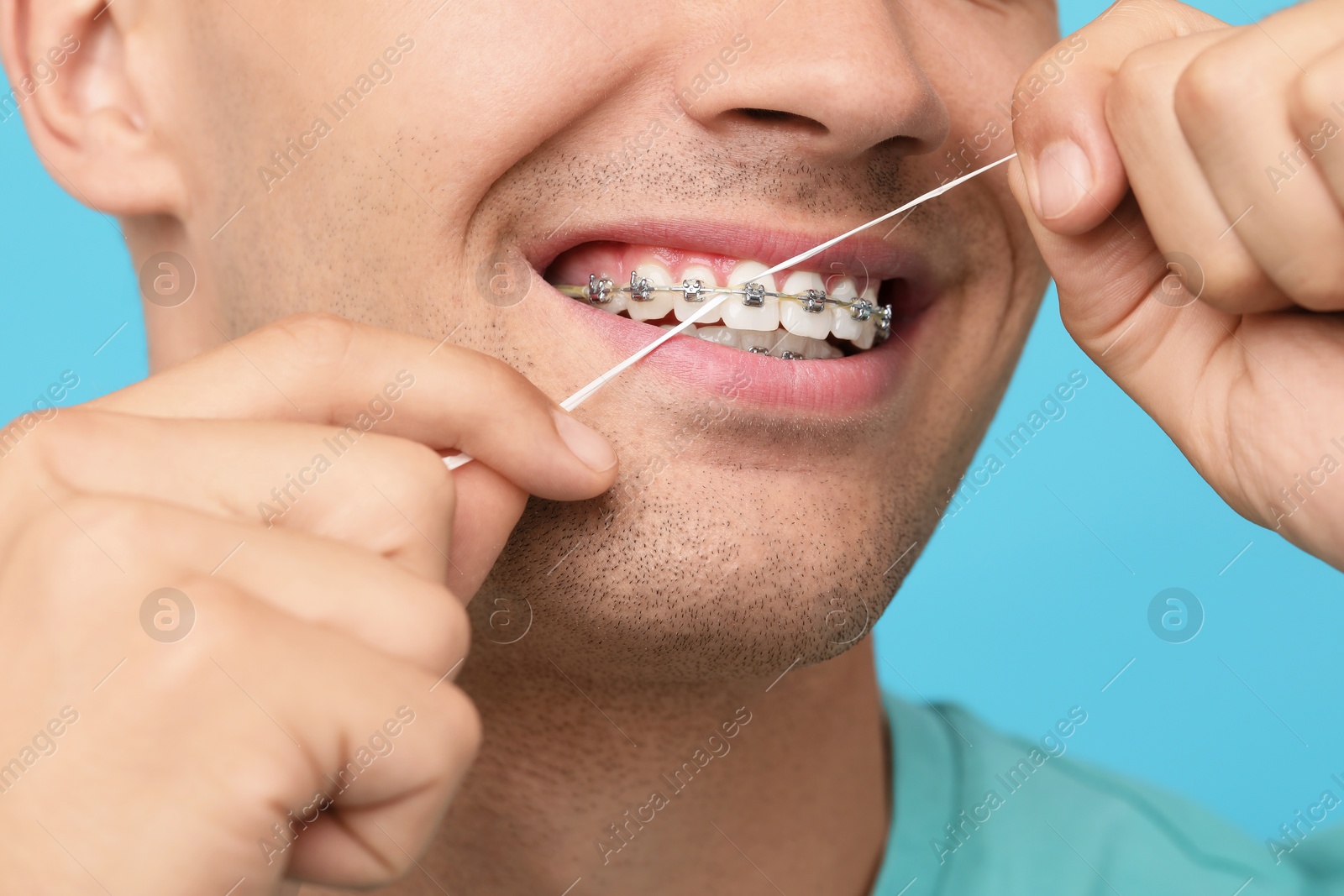 Photo of Man with braces cleaning teeth using dental floss on light blue background, closeup