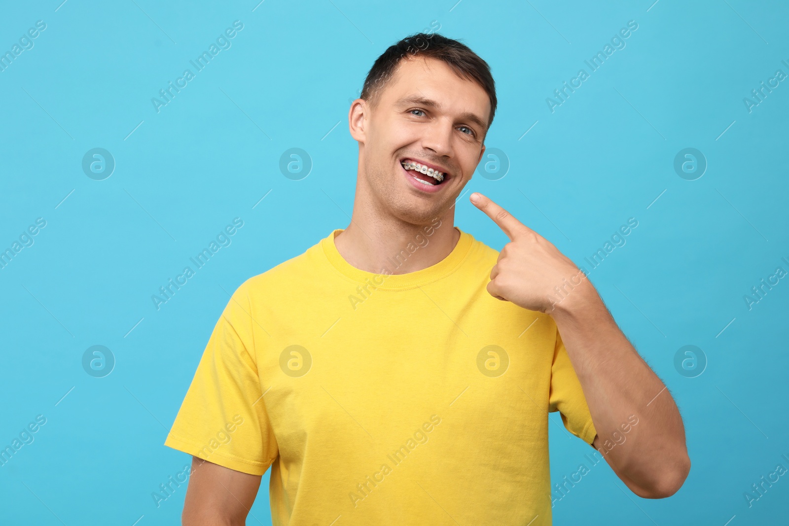 Photo of Smiling man pointing at his dental braces on light blue background