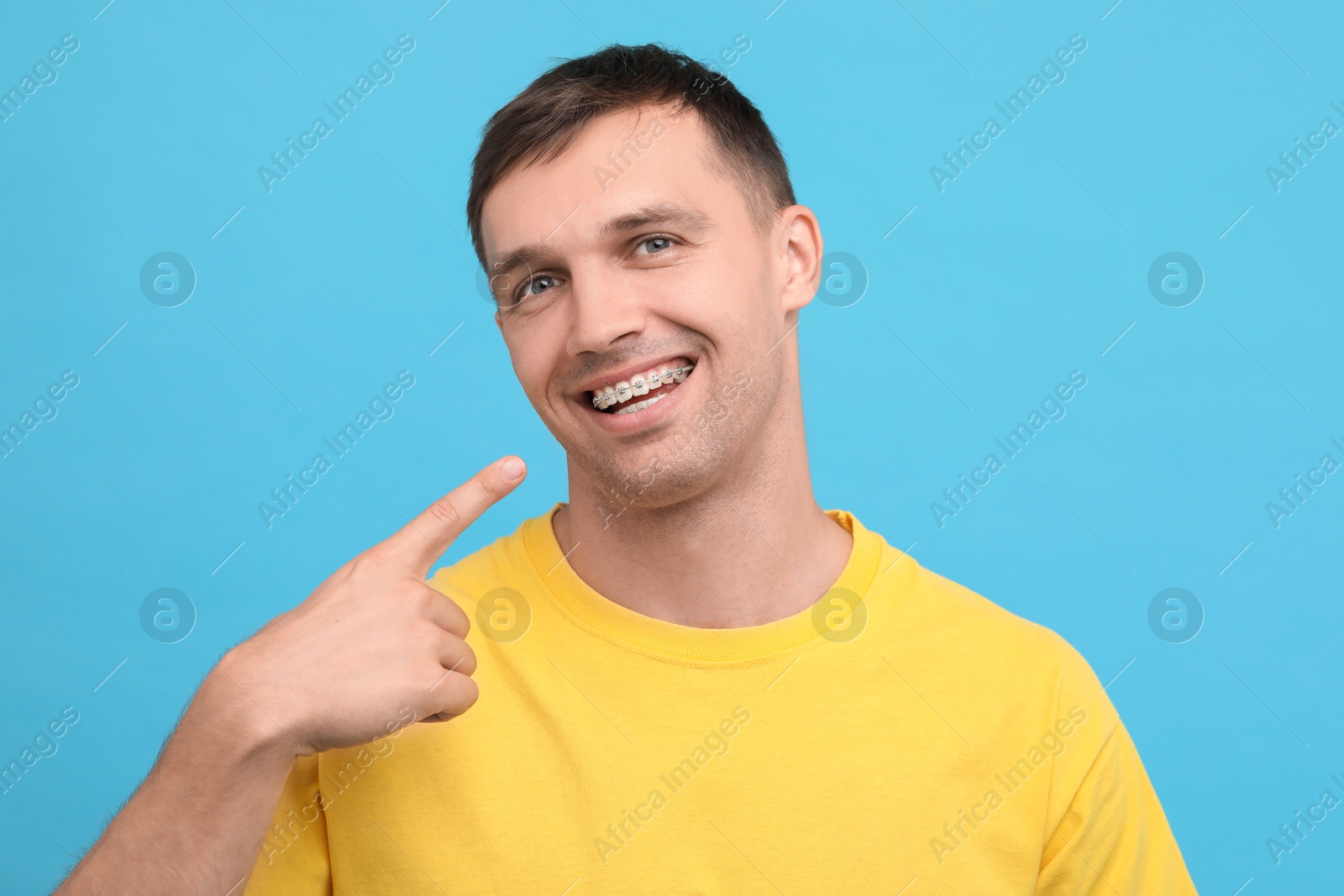 Photo of Smiling man pointing at his dental braces on light blue background