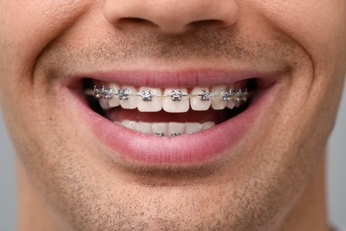 Smiling man with dental braces on grey background, closeup