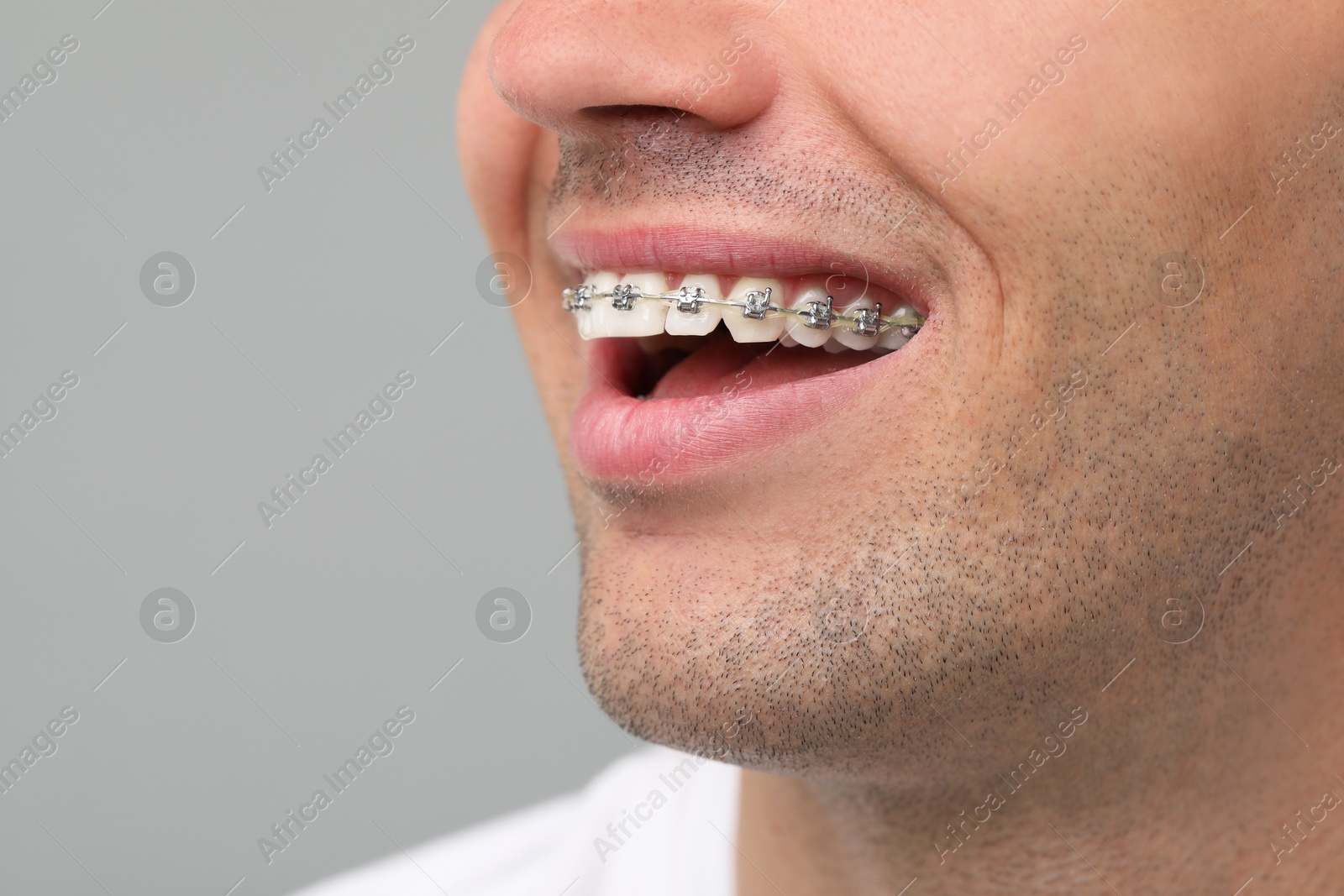 Photo of Happy man with dental braces on grey background, closeup. Space for text