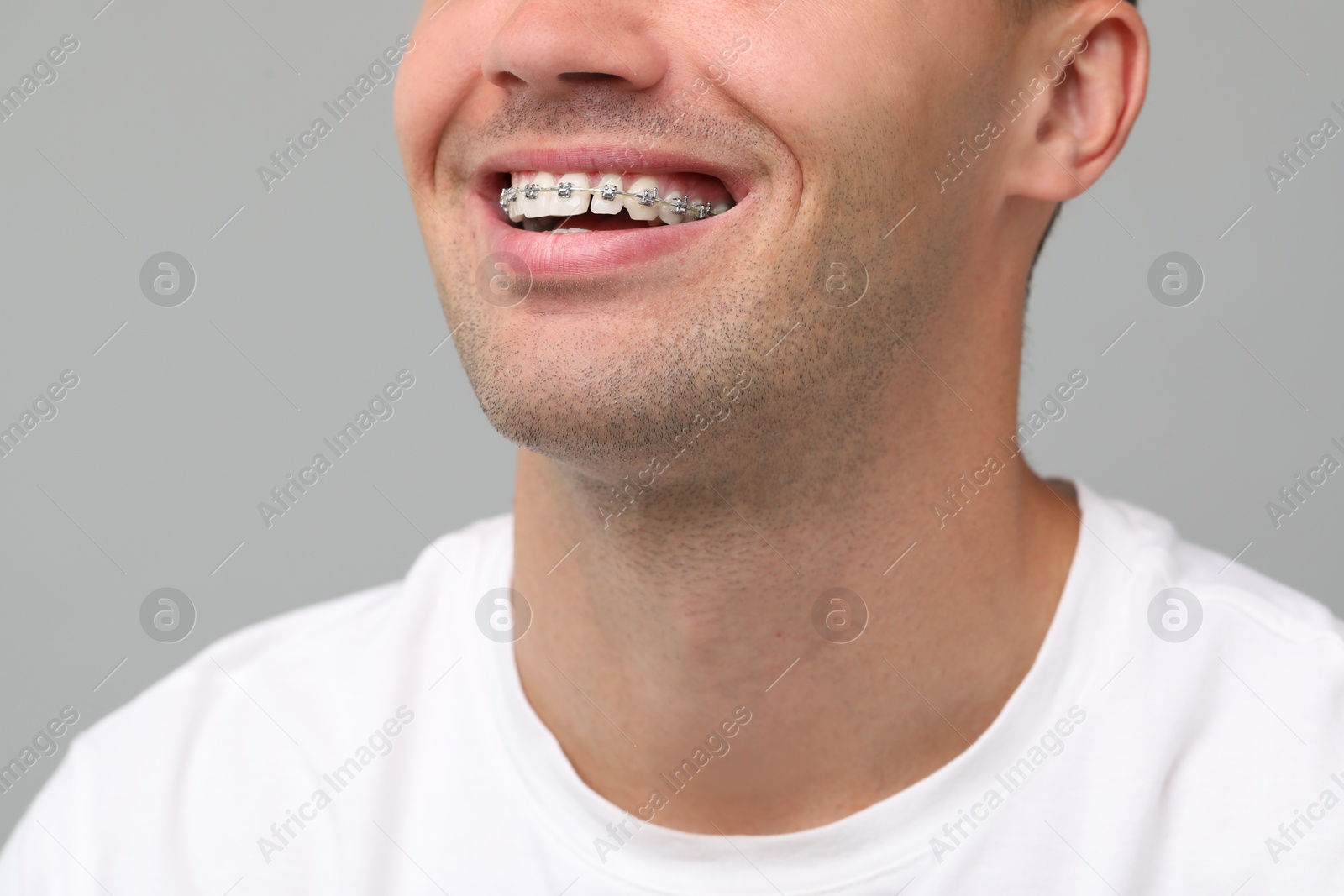 Photo of Smiling man with dental braces on grey background, closeup