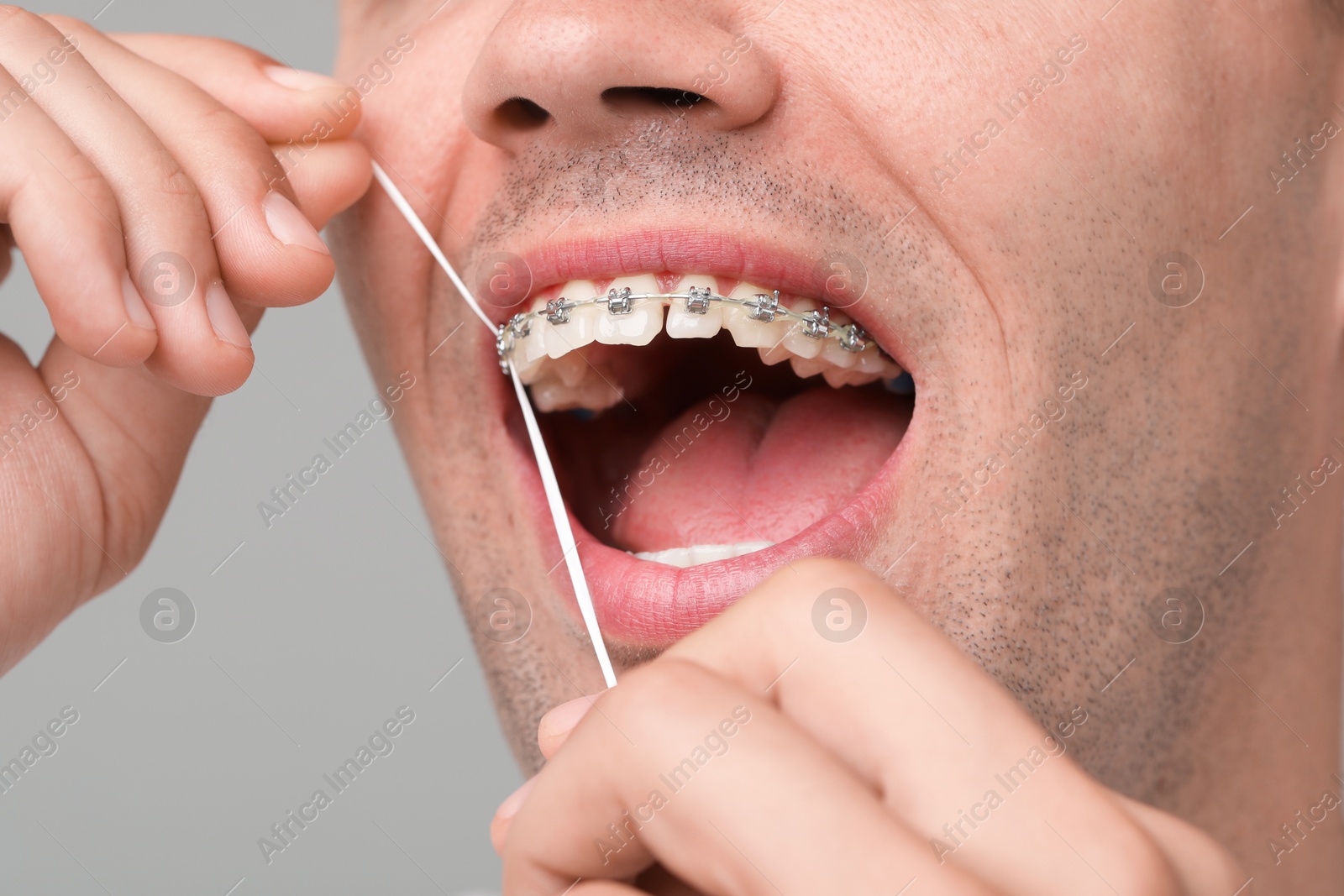 Photo of Man with braces cleaning teeth using dental floss on grey background, closeup