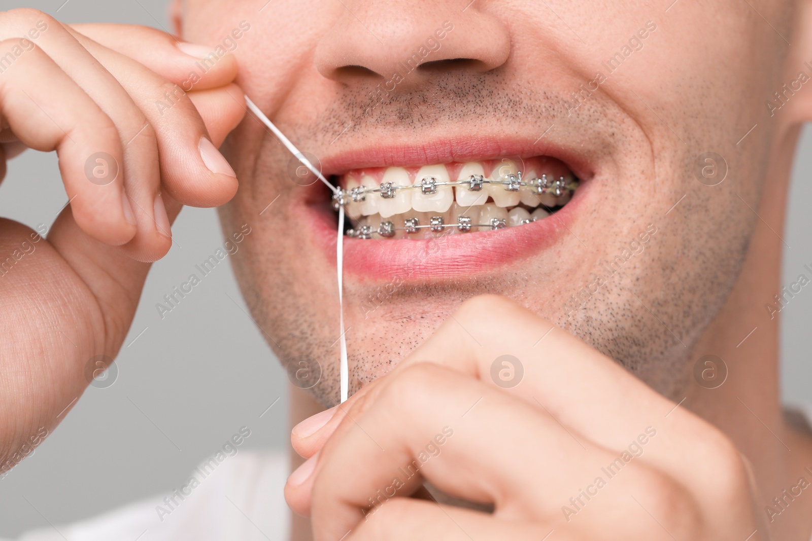 Photo of Man with braces cleaning teeth using dental floss on grey background, closeup