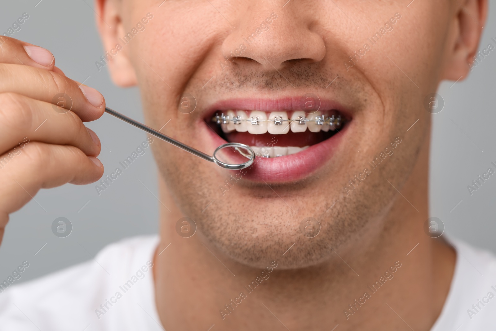 Photo of Examination of man's teeth with braces using mirror tool on grey background, closeup