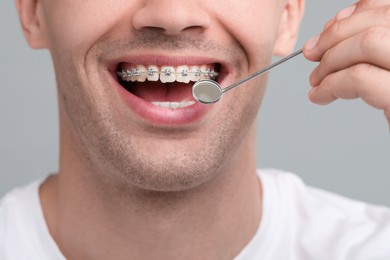 Photo of Examination of man's teeth with braces using mirror tool on grey background, closeup