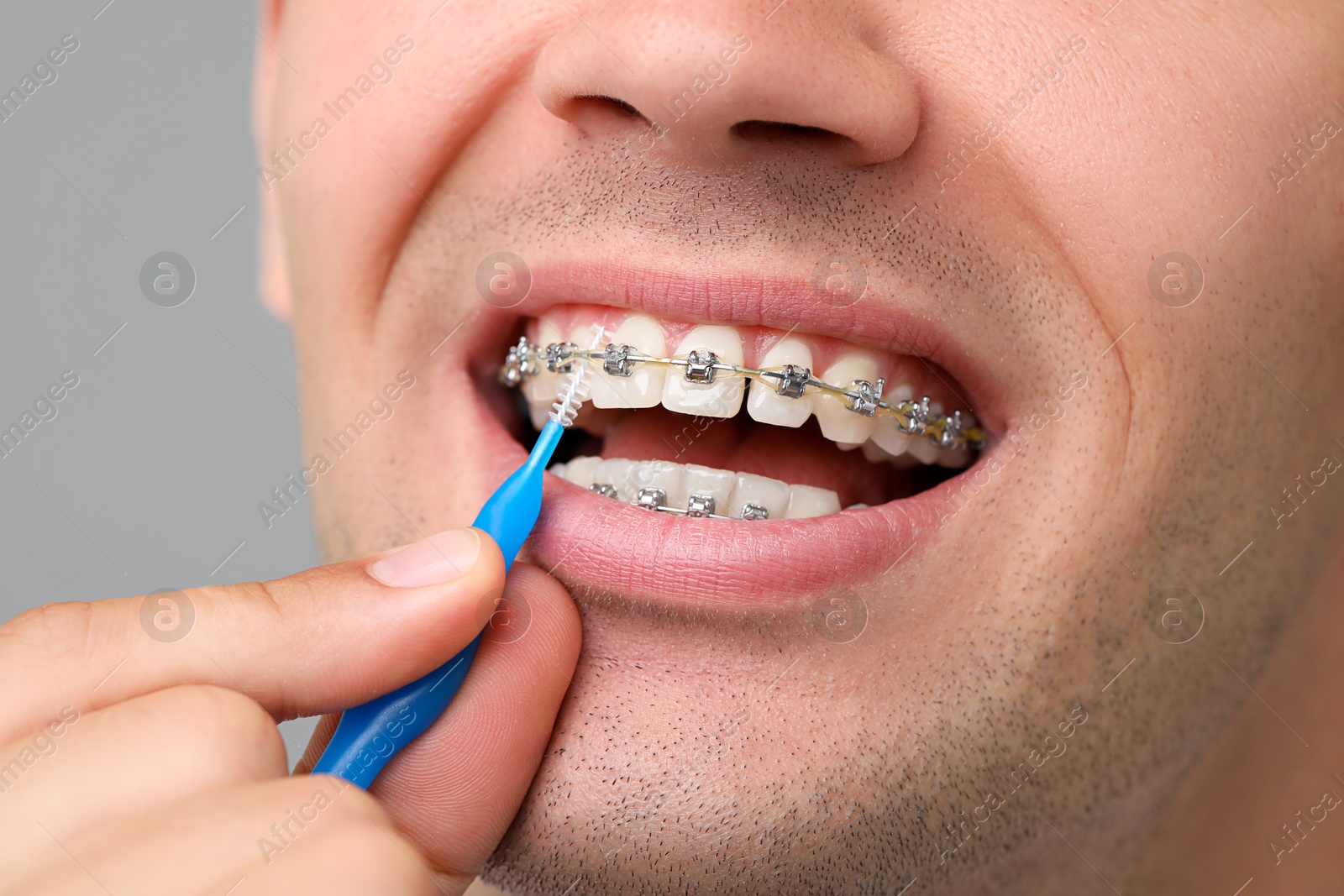 Photo of Man with dental braces cleaning teeth using interdental brush on grey background, closeup