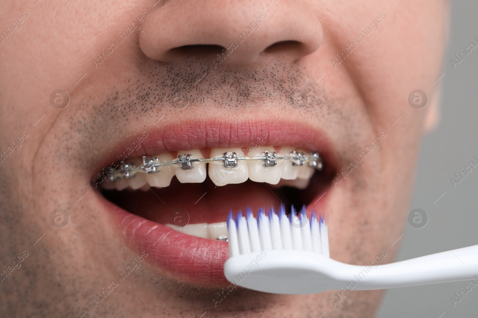 Photo of Man with dental braces cleaning teeth on grey background, closeup