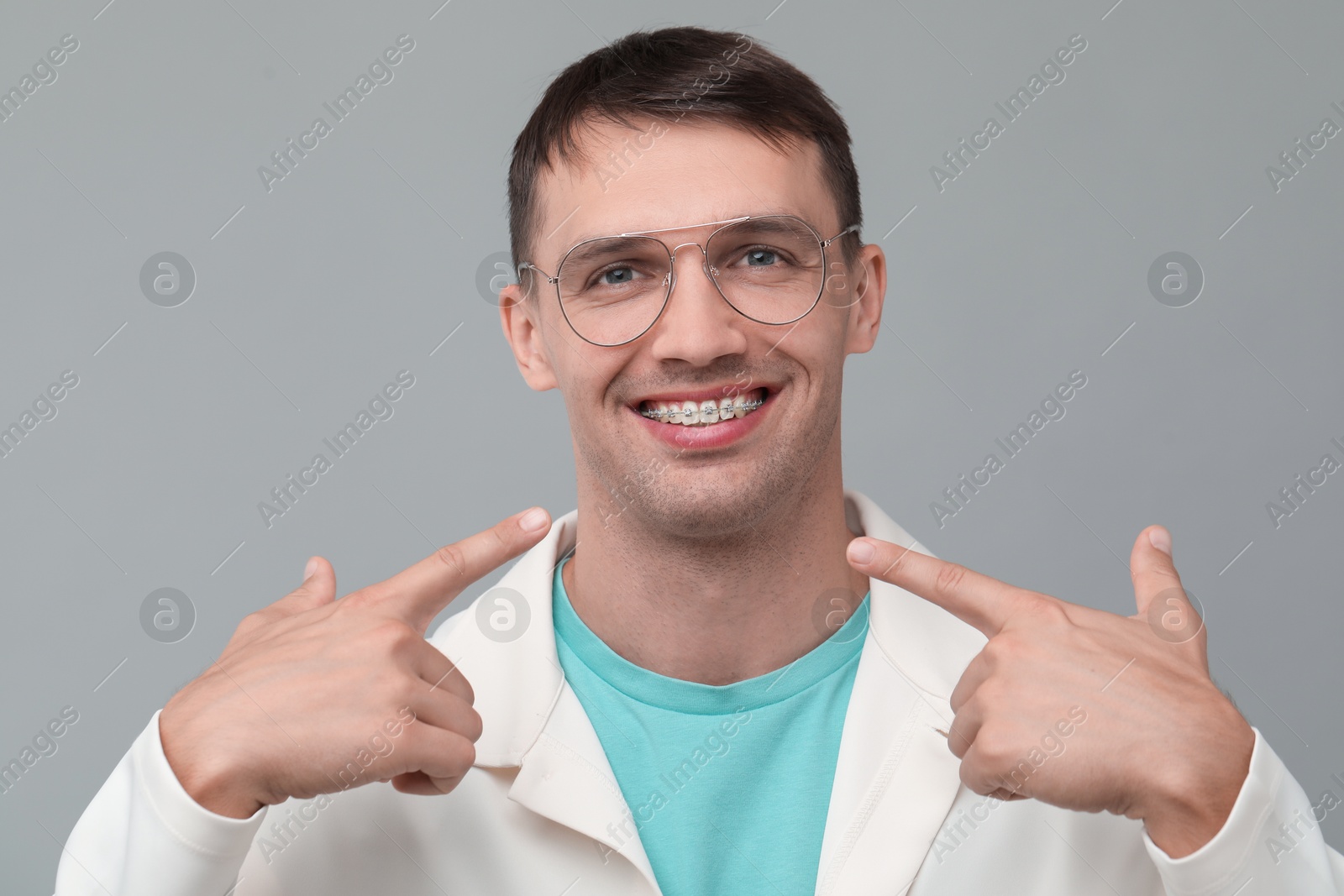 Photo of Happy man pointing at his dental braces on grey background