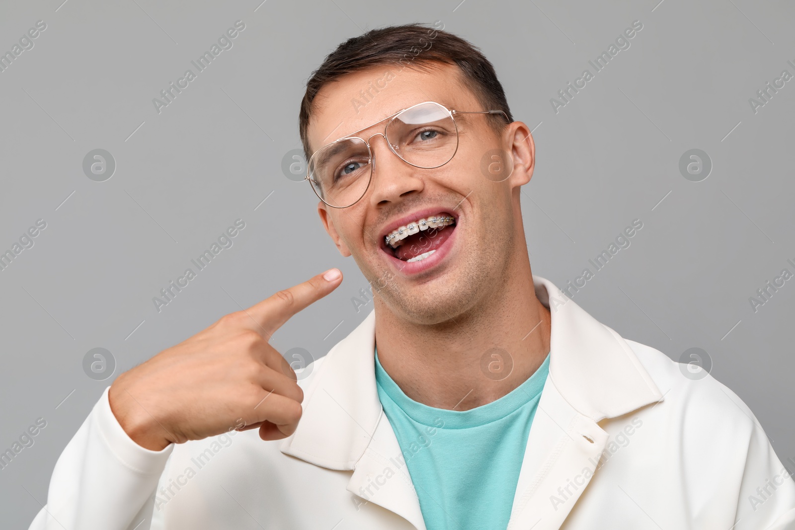 Photo of Happy man pointing at his dental braces on grey background