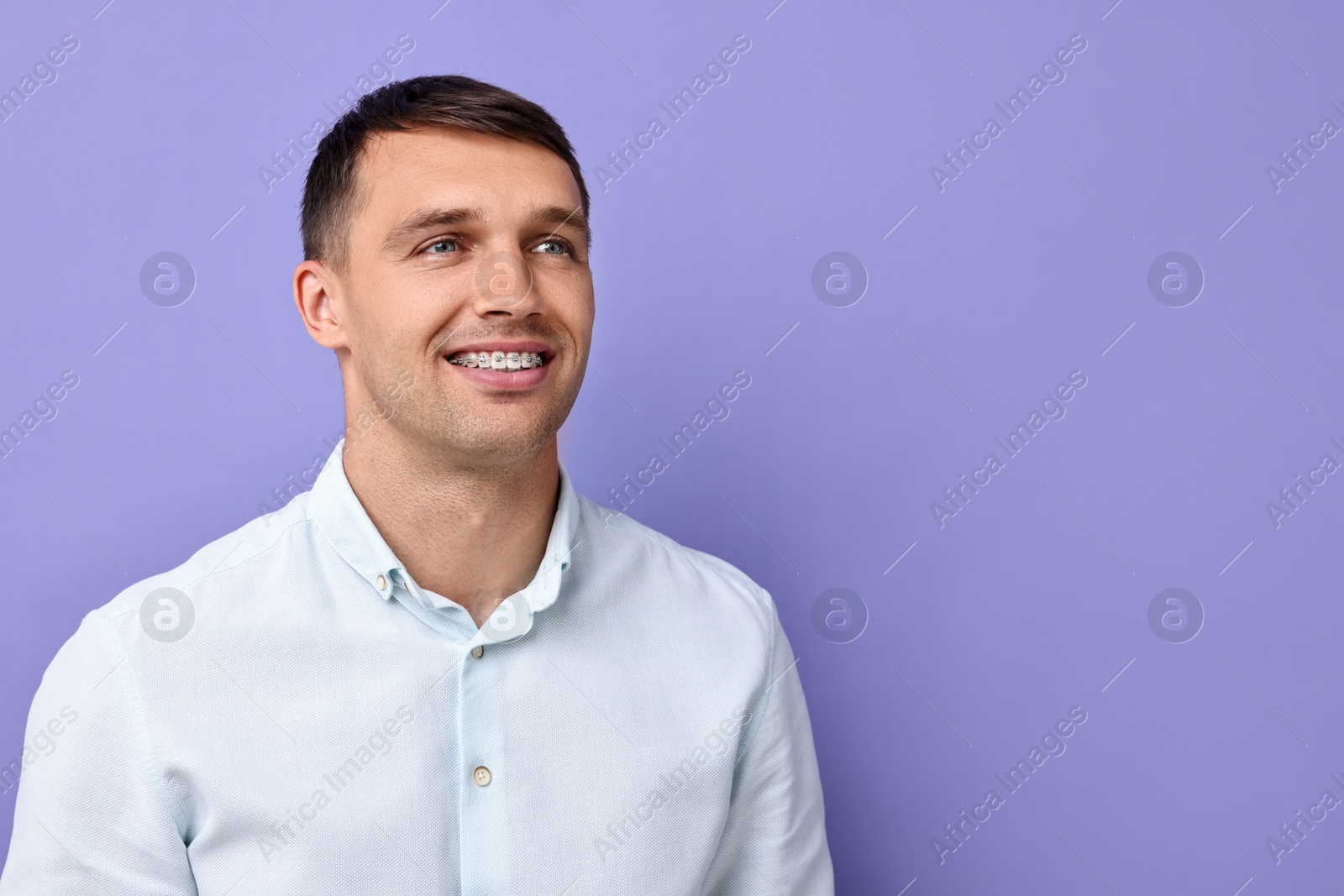 Photo of Smiling man with dental braces on violet background. Space for text