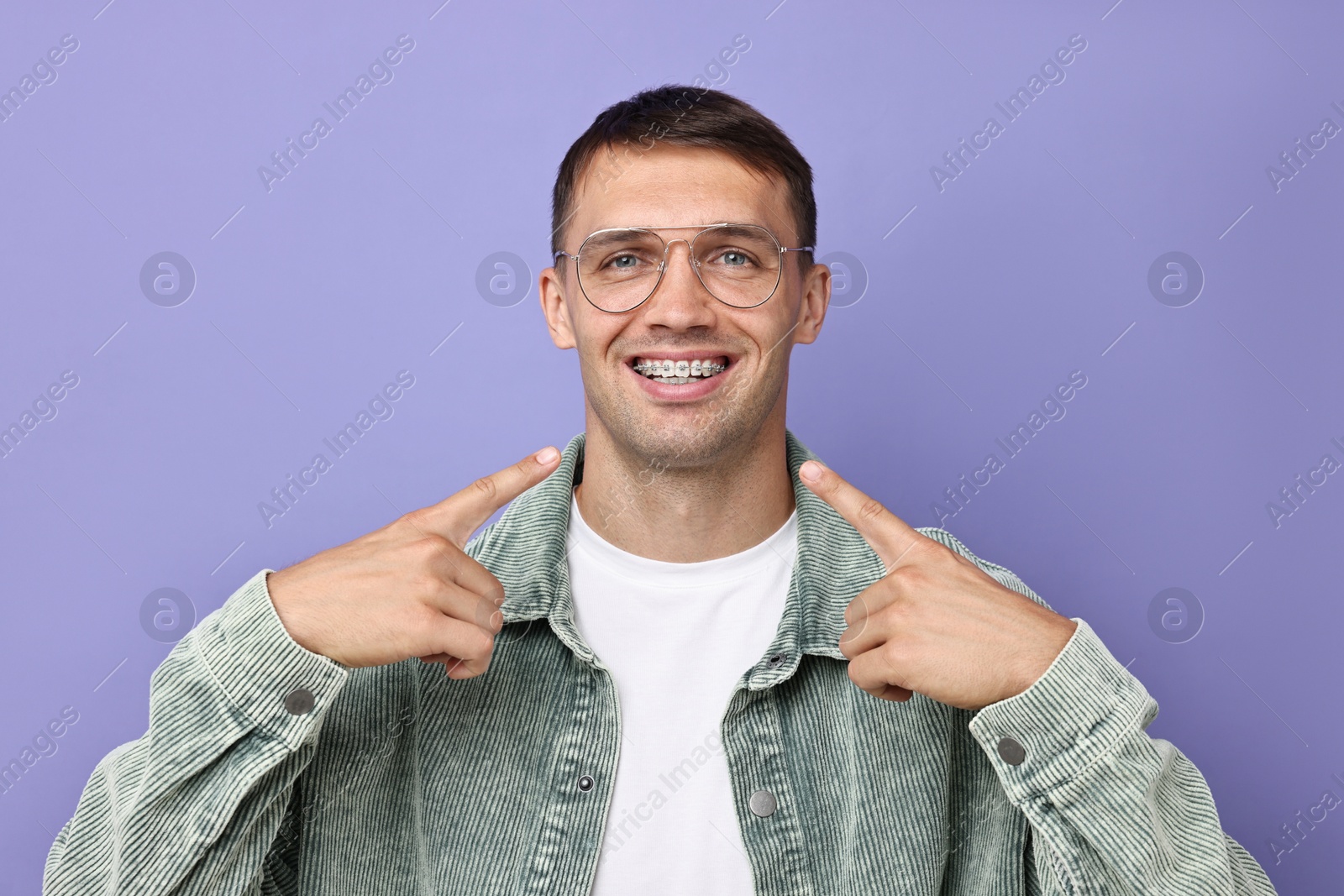 Photo of Happy man pointing at his dental braces on violet background