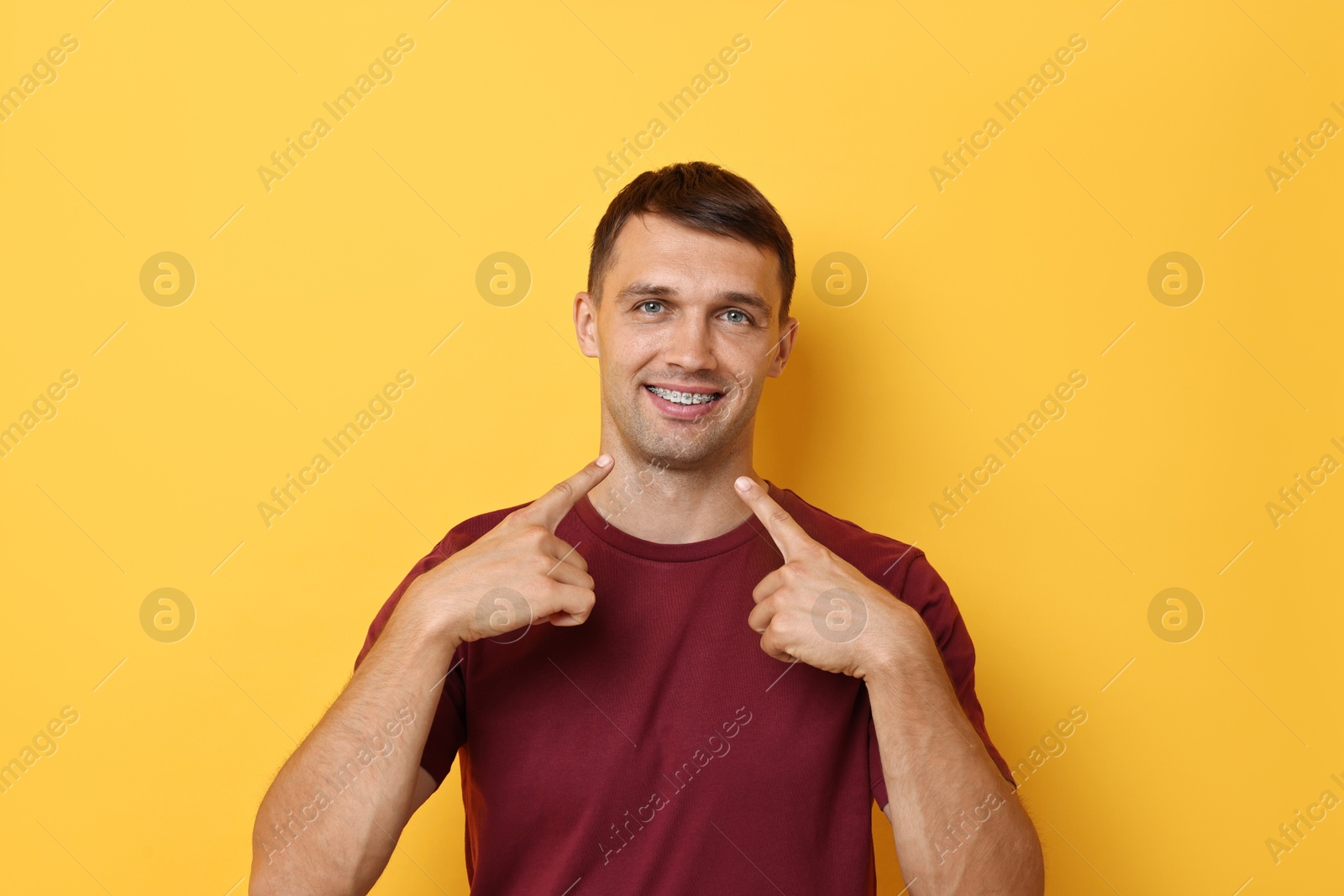 Photo of Smiling man pointing at his dental braces on yellow background