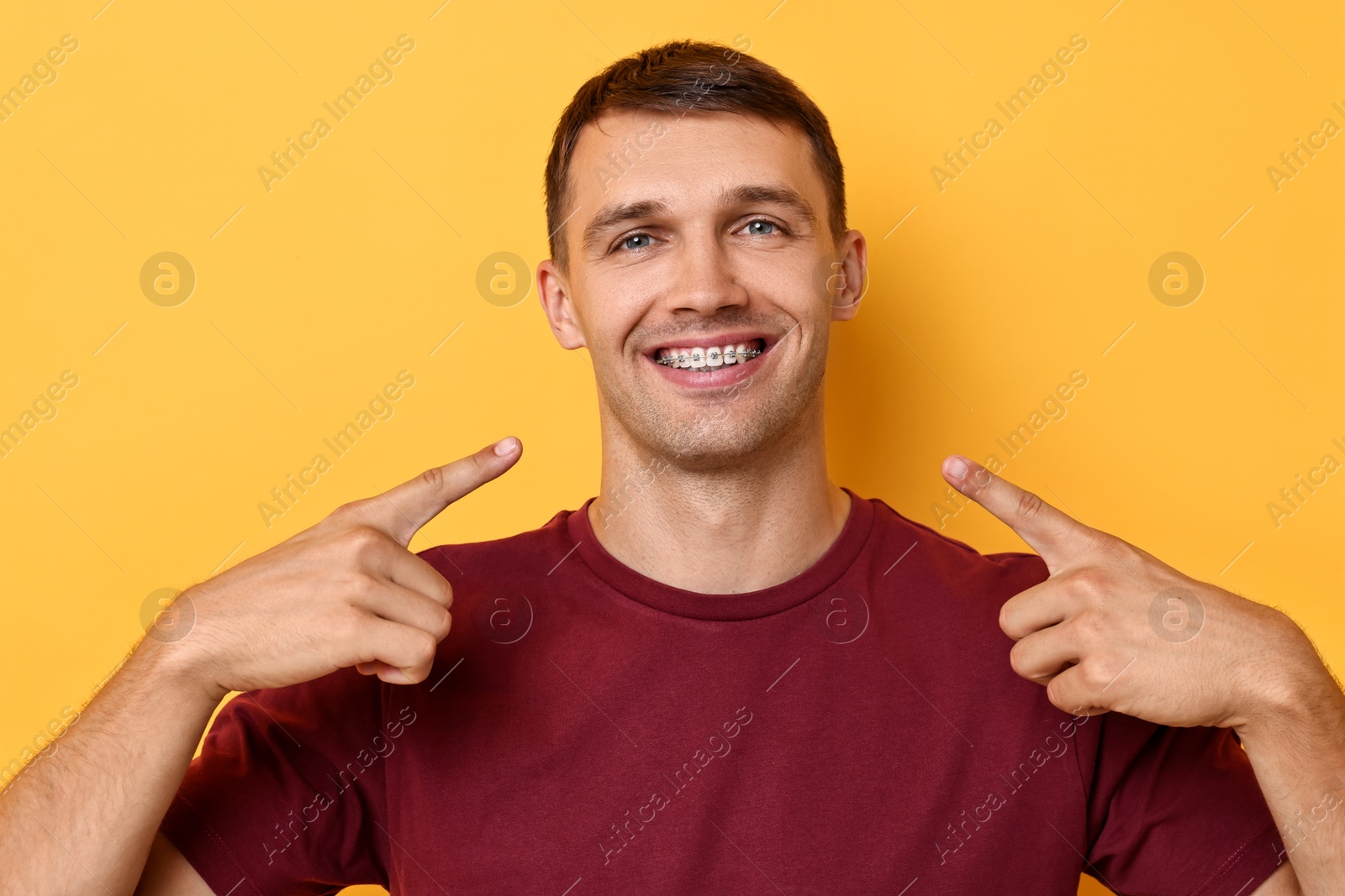 Photo of Smiling man pointing at his dental braces on yellow background