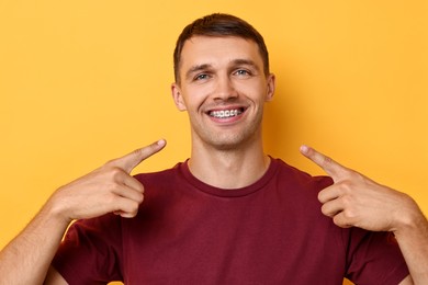 Smiling man pointing at his dental braces on yellow background