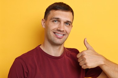 Smiling man with dental braces showing thumbs up on yellow background