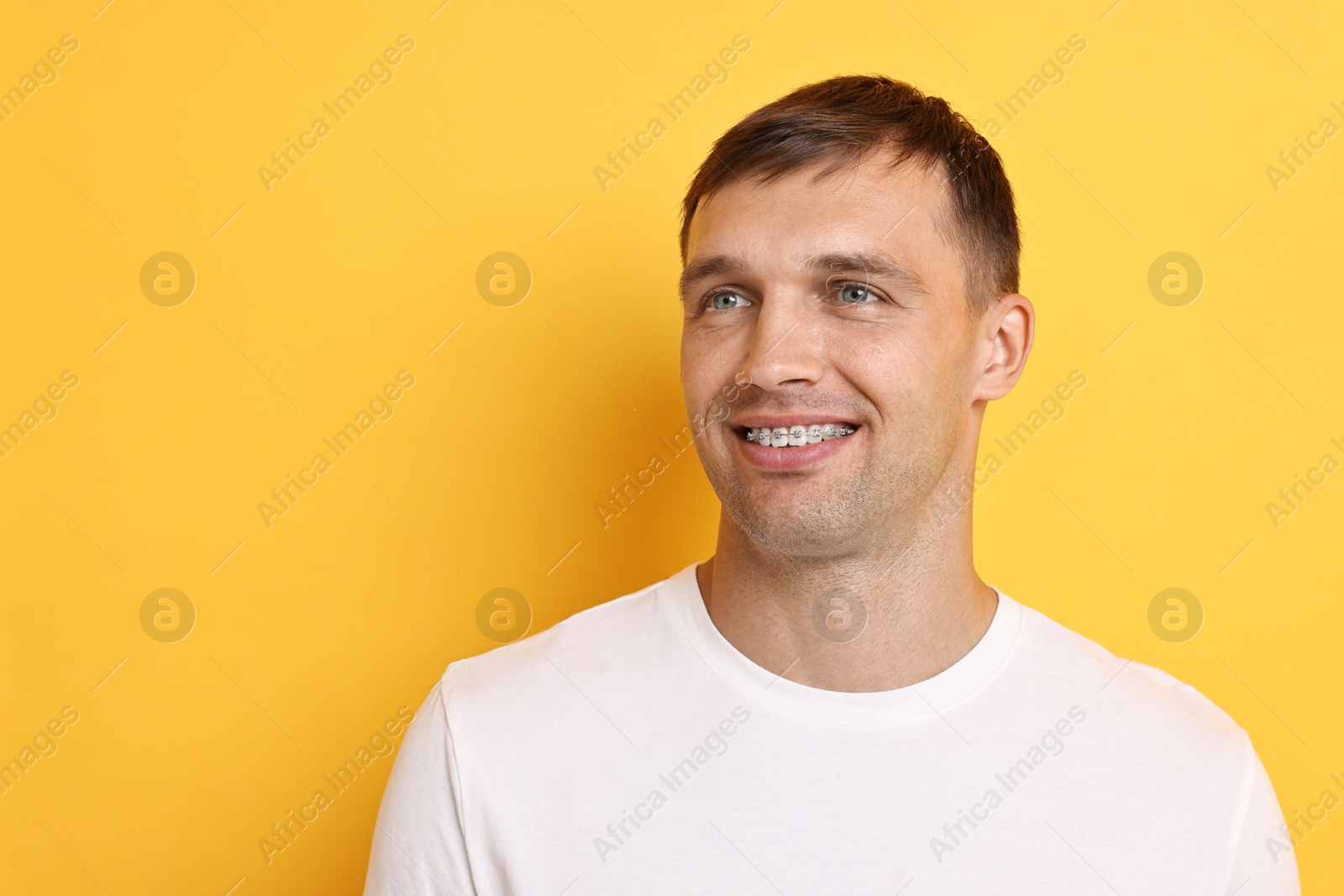 Photo of Smiling man with dental braces on yellow background. Space for text