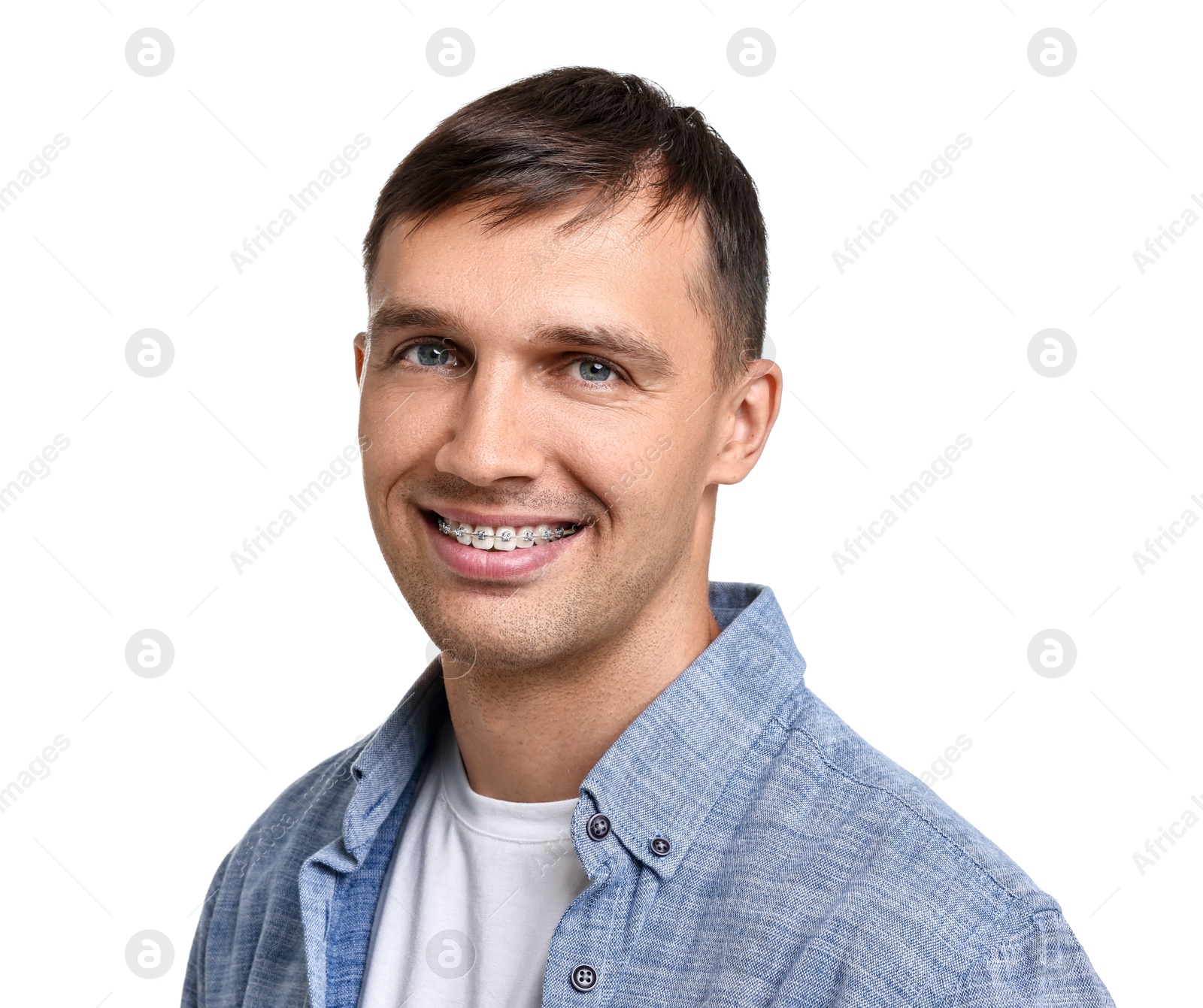 Photo of Smiling man with dental braces on white background