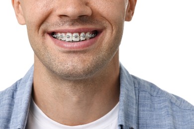 Smiling man with dental braces on white background, closeup