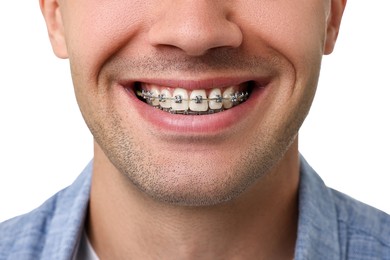 Photo of Smiling man with dental braces on white background, closeup