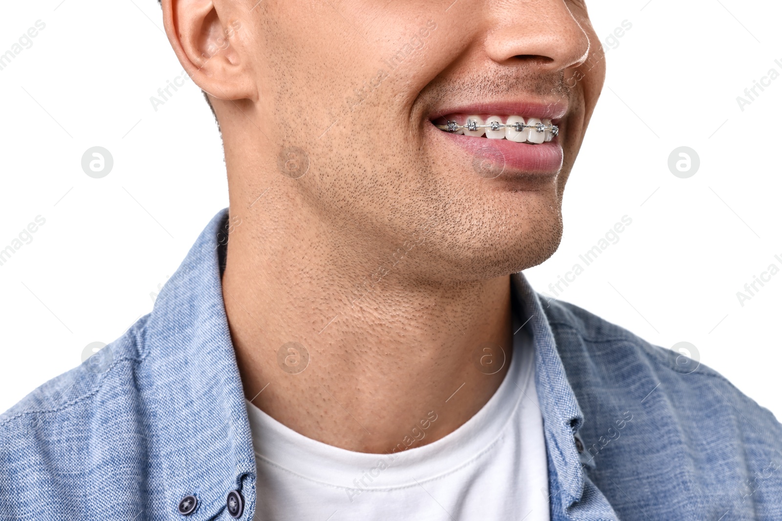 Photo of Smiling man with dental braces on white background, closeup