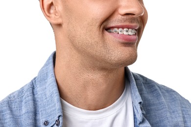 Smiling man with dental braces on white background, closeup