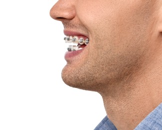 Happy man with dental braces on white background, closeup