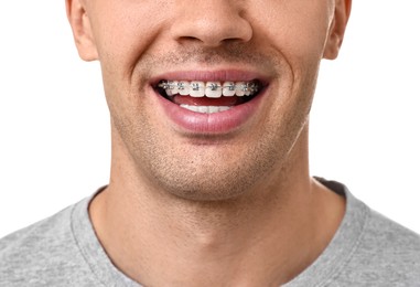 Smiling man with dental braces on white background, closeup