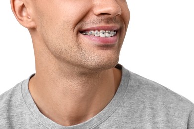 Smiling man with dental braces on white background, closeup