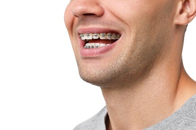 Photo of Happy man with dental braces on white background, closeup