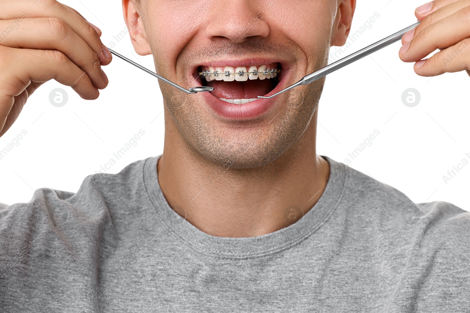 Photo of Examination of man's teeth with braces using dental tools on white background, closeup