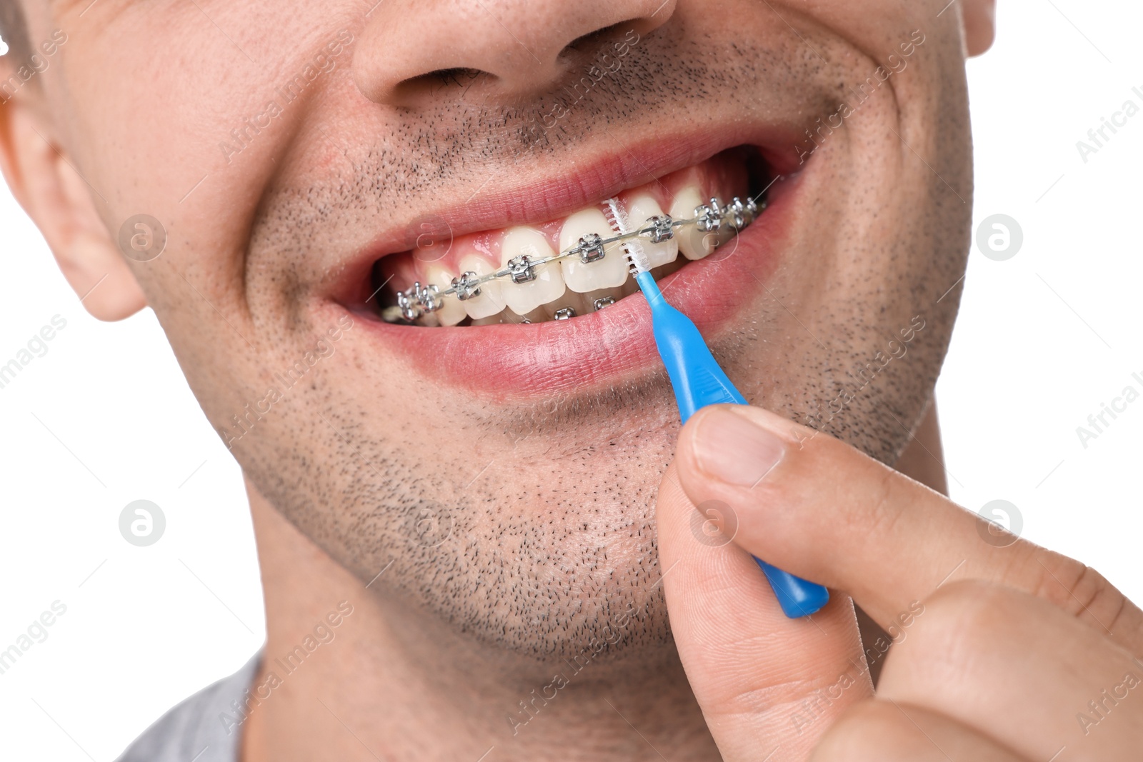 Photo of Man with dental braces cleaning teeth using interdental brush on white background, closeup