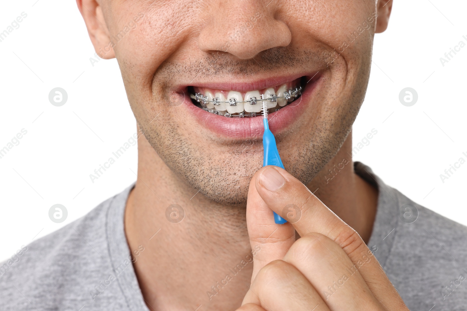 Photo of Man with dental braces cleaning teeth using interdental brush on white background, closeup