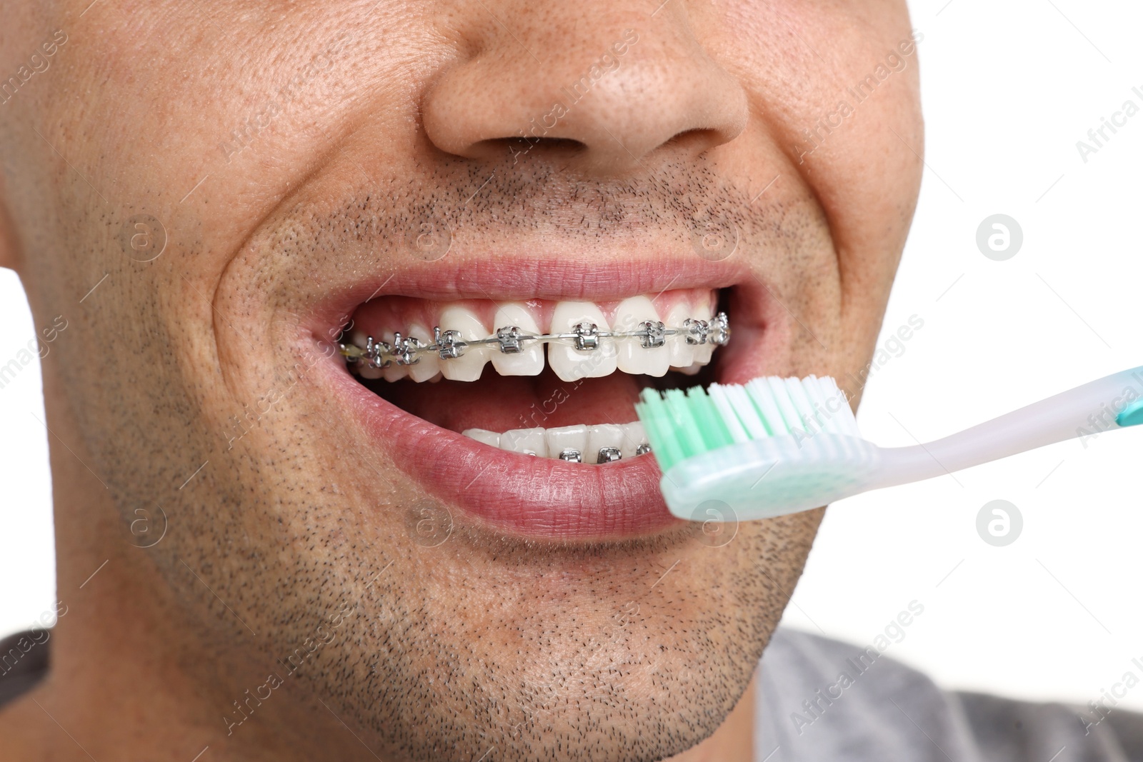 Photo of Man with dental braces cleaning teeth on white background, closeup