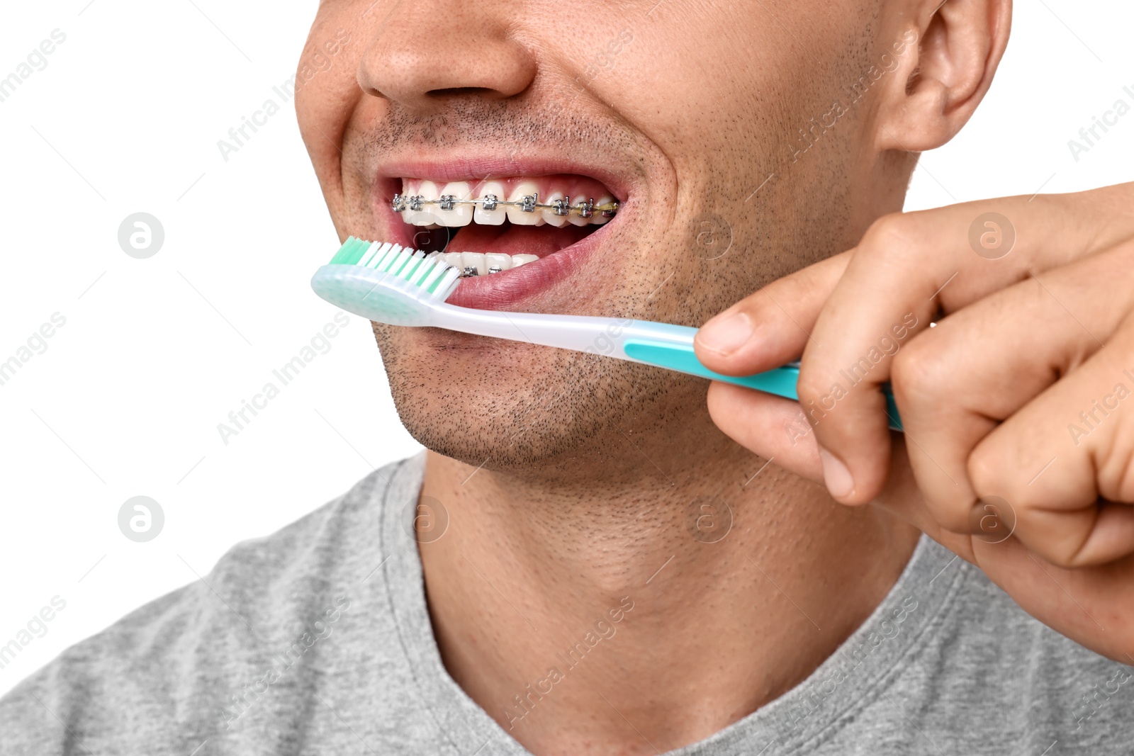 Photo of Man with dental braces cleaning teeth on white background, closeup