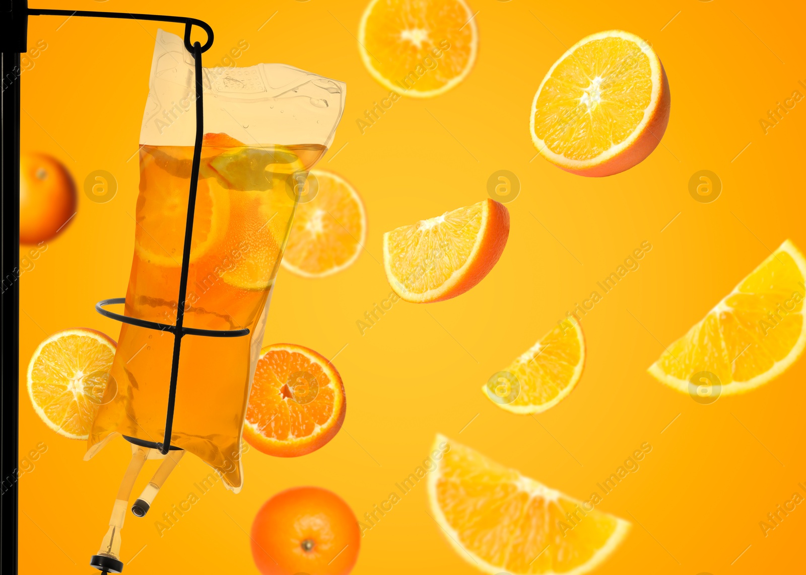 Image of Vitamin intravenous therapy. IV infusion set and falling oranges on bright background